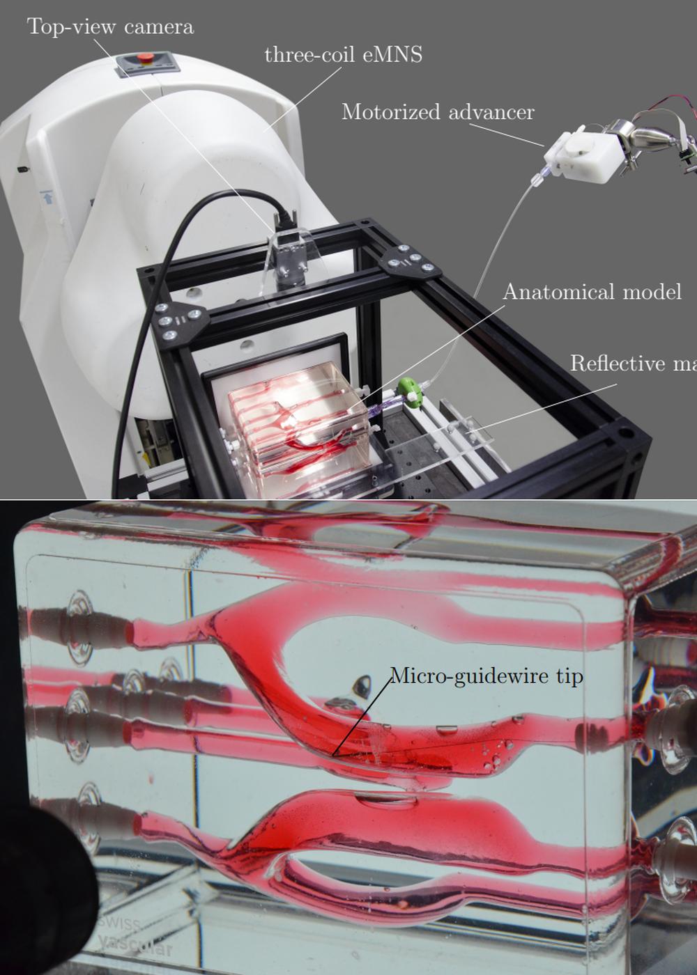 Swiss Vascular Ventricular Module Supports Advanced Magnetic Navigation