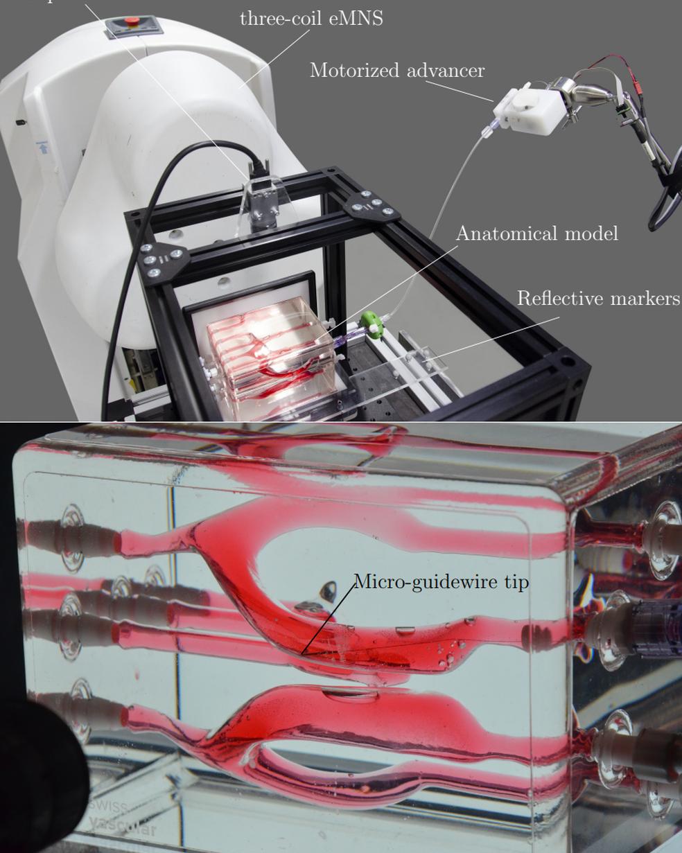 Swiss Vascular Ventricular Module Supports Advanced Magnetic Navigation