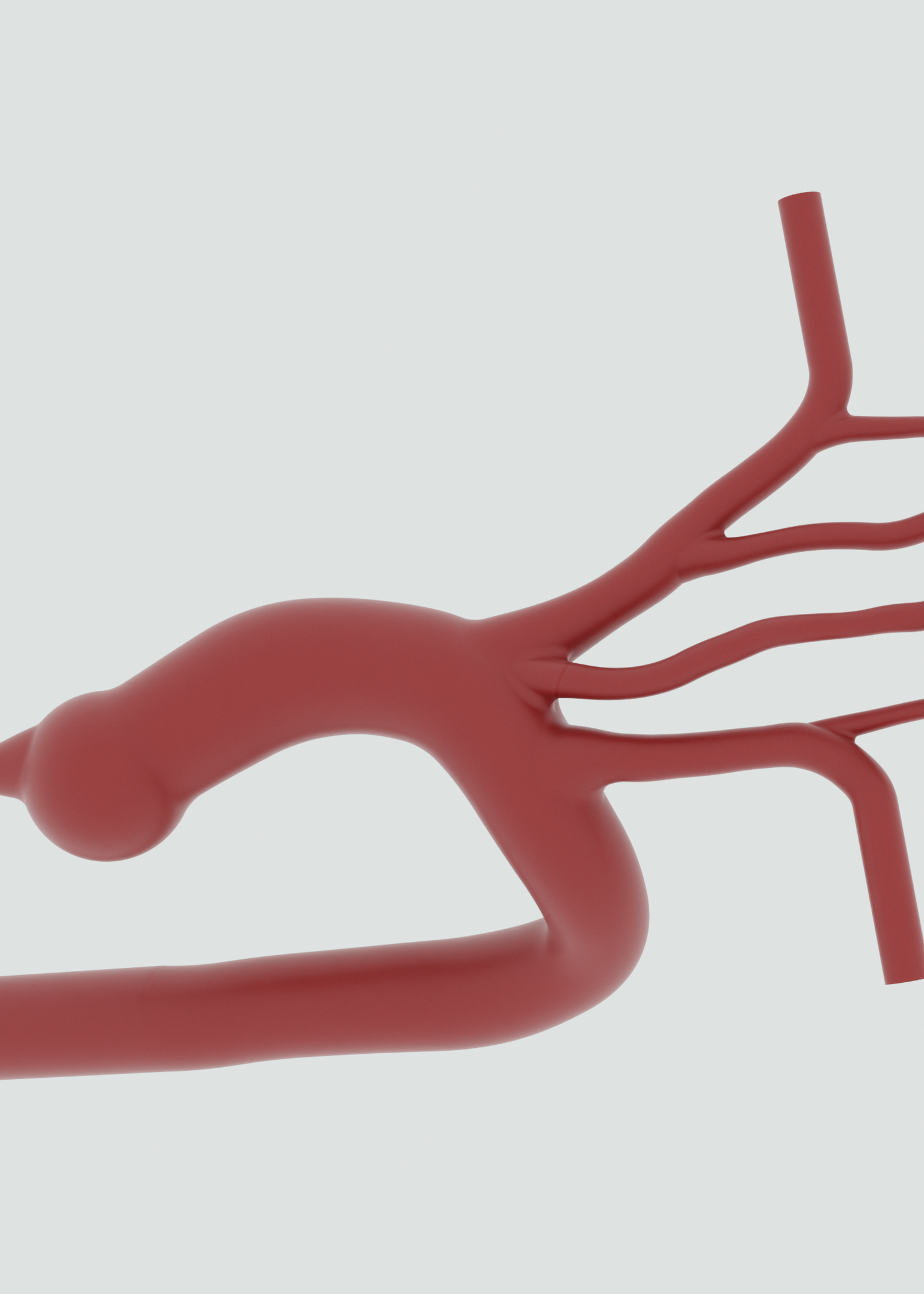Type I Aortic Arch