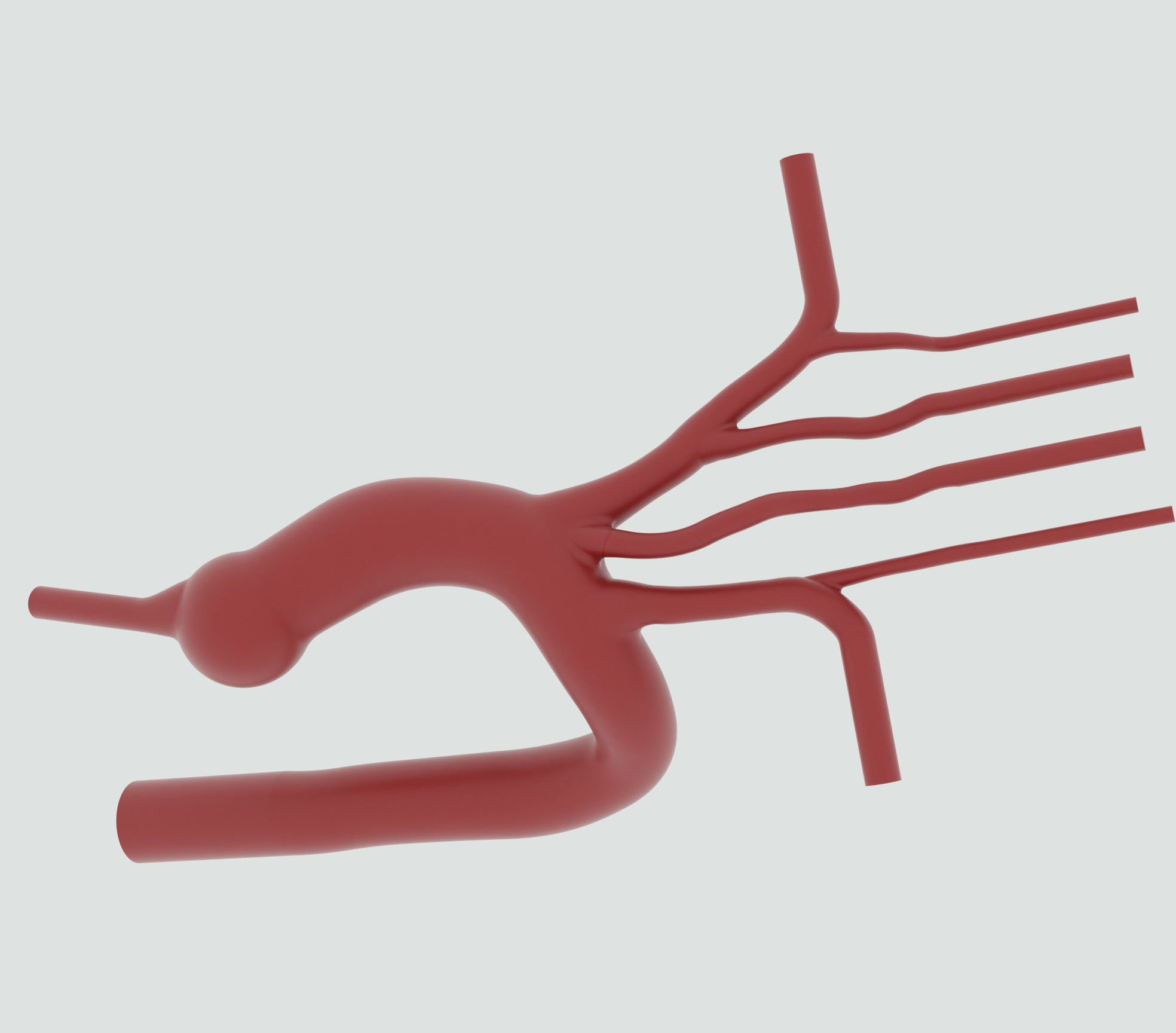 Type I Aortic Arch