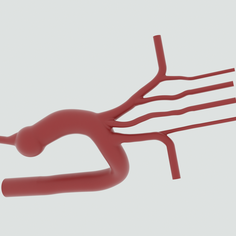 Image of Type I Aortic Arch