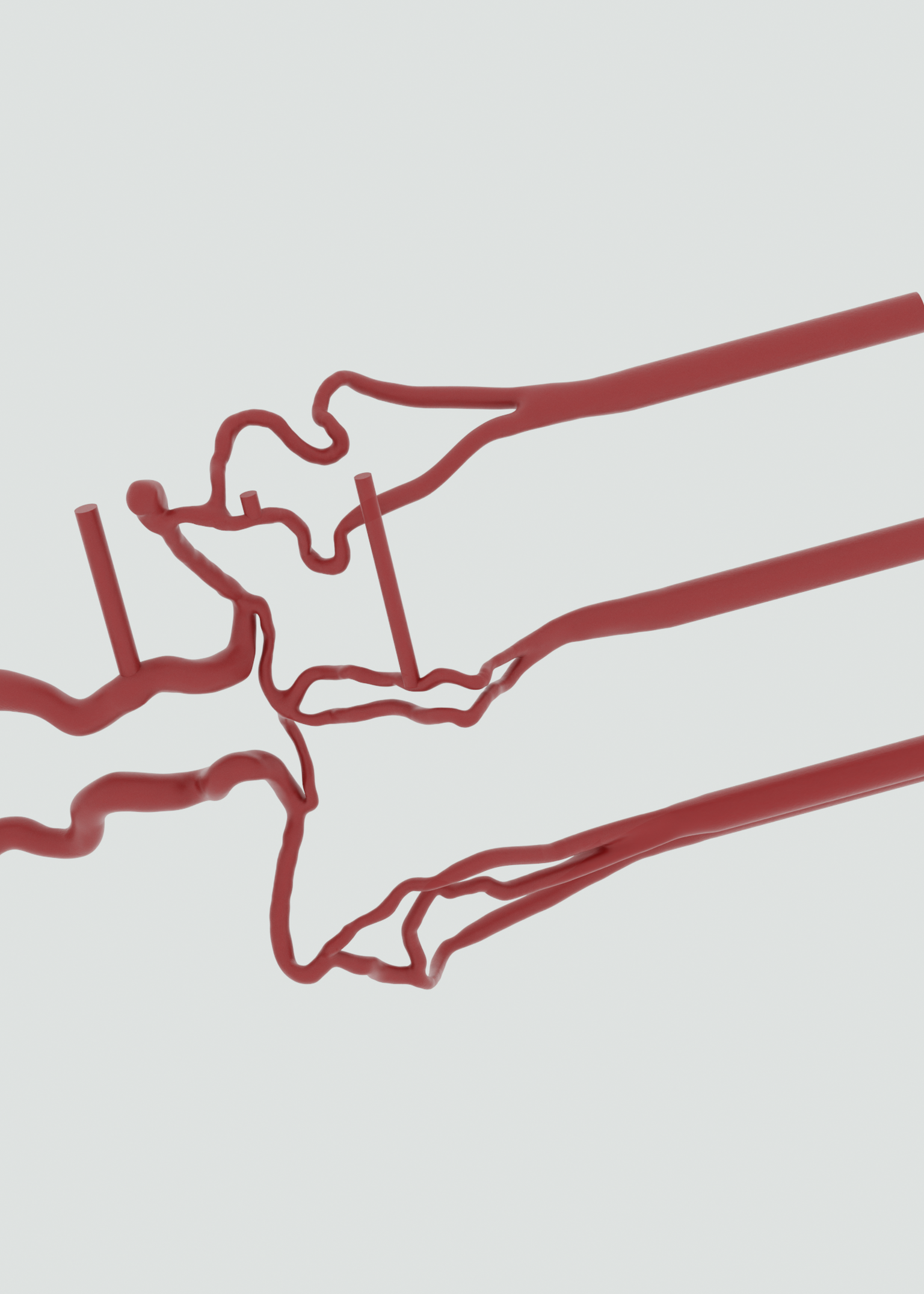 Cerebral Thrombectomy