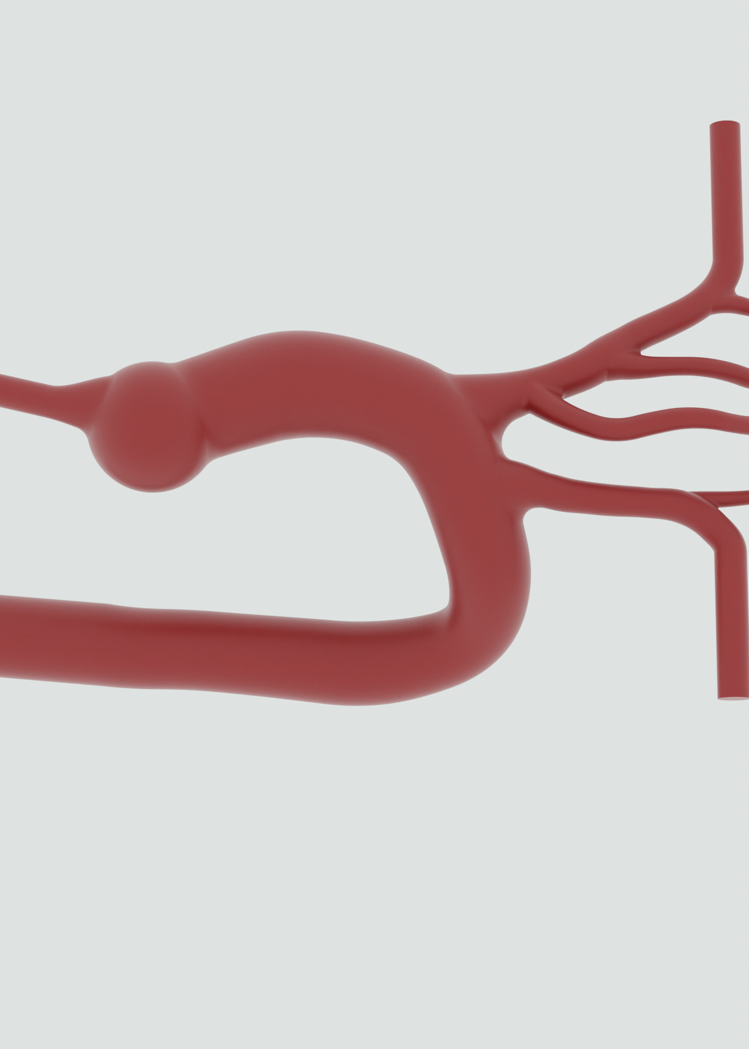 Bovine Aortic Arch