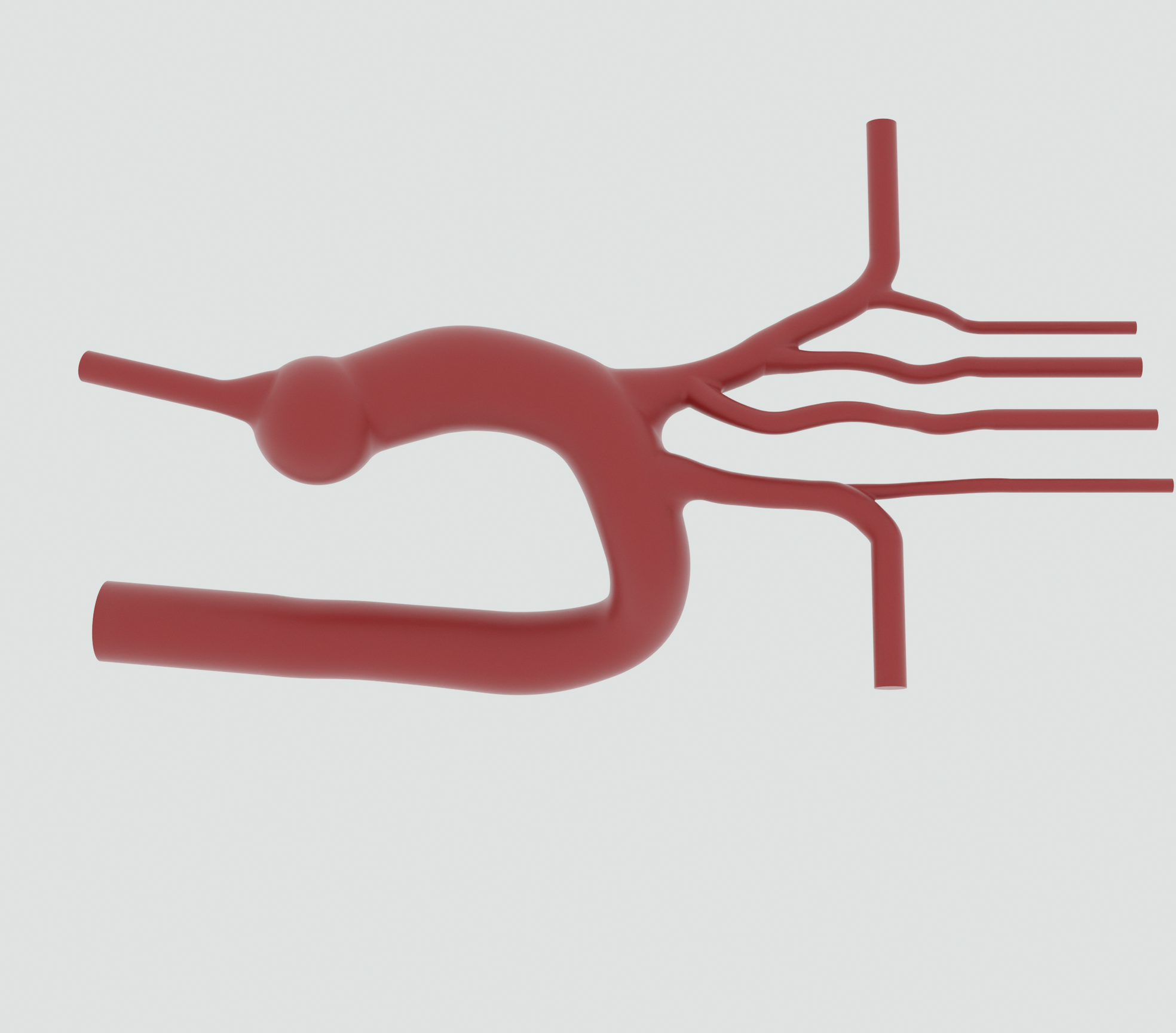 Bovine Aortic Arch
