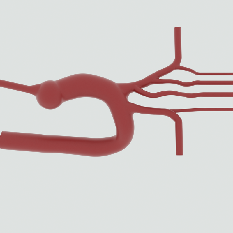 Image of Bovine Aortic Arch