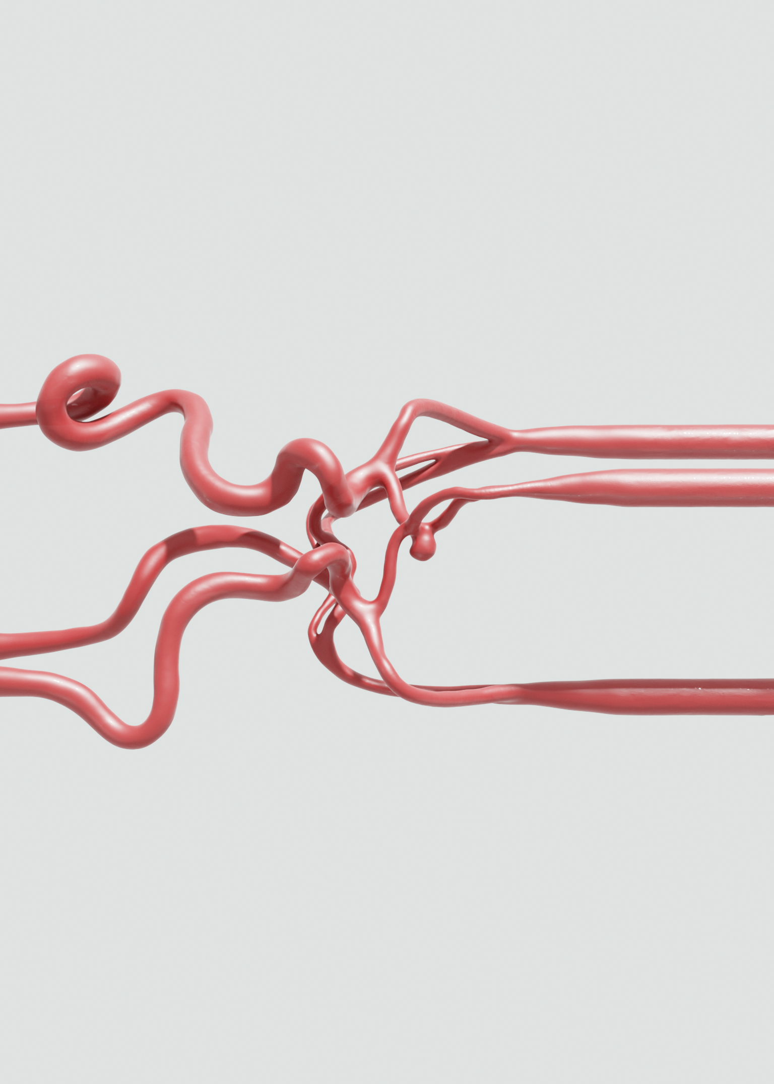 Anterior Communicating Artery 360