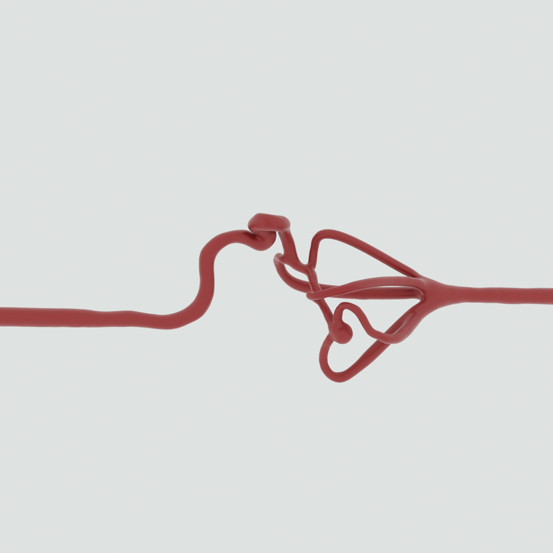 Image of Middle Cerebral Artery M2